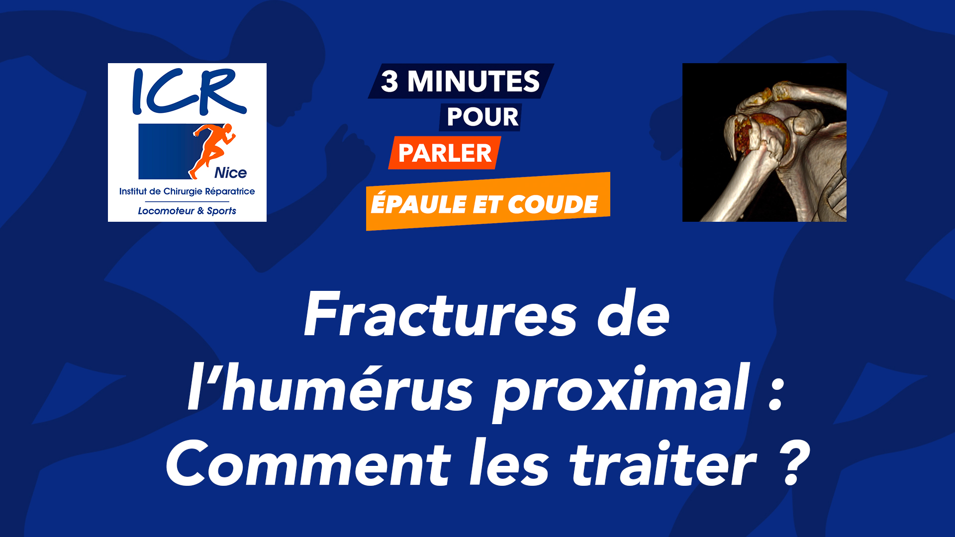 Fractures de l'humérus proximal quelle prise en charge ? Institut de